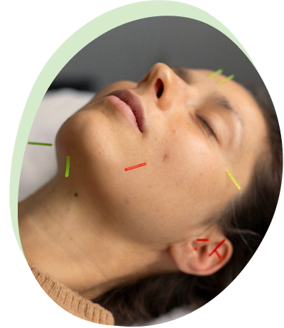 Facial Rejuvenation Acupuncture